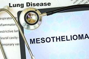Mesothelioma / Asbestos
